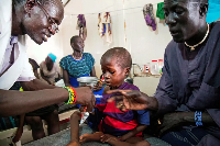 A medical officer from Doctors Without Borders attends to a child with malnutrition