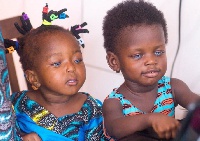 Ghanaian toddlers with blue eyes -- Photo: Francis Osei-Owusu