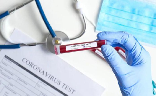 Coronavirus: Ghana’s active cases pass three-thousand as deaths increase by 6