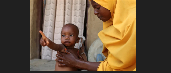 Rashida Musa, 29, tends to her sick child who was sent home from the hospital with malnutrition