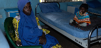 Hussaina Alhassan, right, after facial reconstructive surgery for noma
