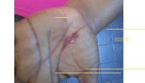 An injury from one of the alleged attacks on the wife