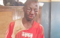 Ishmael Nartey after he was rescued from the irate youth by the police.