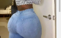 File photo of an enhanced butt