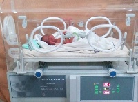 The preterm baby in one of the incubators presented to the hospital
