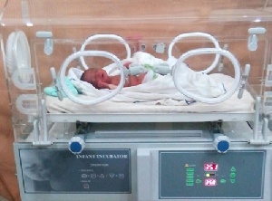 The preterm baby in one of the incubators presented to the hospital