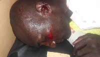 The policeman is currently in a critical condition at the Bolgatanga regional hospital