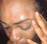 Shatta Mitchy posted this swollen face picture on her Facebook page