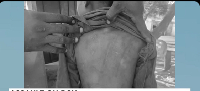 A screenshot of the boy's back with strokes of cane markings