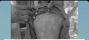 A screenshot of the boy's back with strokes of cane markings