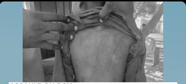 A screenshot of the boy's back with strokes of cane markings