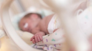 File photo: A baby receiving care after childbirth