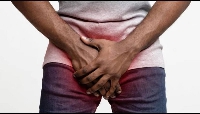 Research show say many cases of penile fracture na due to vigorous sexual activity