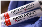 Africa CDC urges member states to strengthen surveillance after hantavirus outbreak