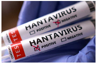Africa CDC urges member states to strengthen surveillance after hantavirus outbreak