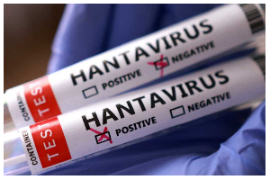 Africa CDC urges member states to strengthen surveillance after hantavirus outbreak