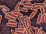 Suspected Russian plague case unlikely to become another COVID-19 - Medical Expert