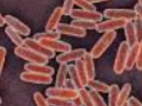 File photo of a virus