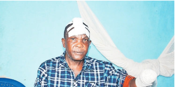 Ephraim Kasujja displays the injuries he sustained after the attack in Kangulumira, Kayunga District