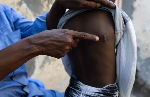 The human cost of surging US air strikes in Somalia