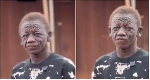 'I was denied education because of my face' - Young man recounts painful ordeal
