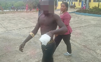 One of the injured victim of the Bibiani Anhwiaso Bekwai attack