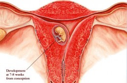 Embryo  Abortion