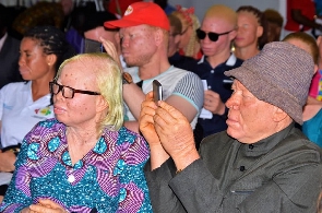 Persons with albinism still face discrimination