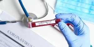 File Photo: Coronavirus test