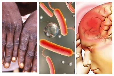 Mpox, cholera and meningitis outbreaks were recorded in 2025