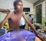How kidnapped 15-year-old boy got shot in jaw by abductors