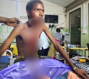 The victim Issah Ali