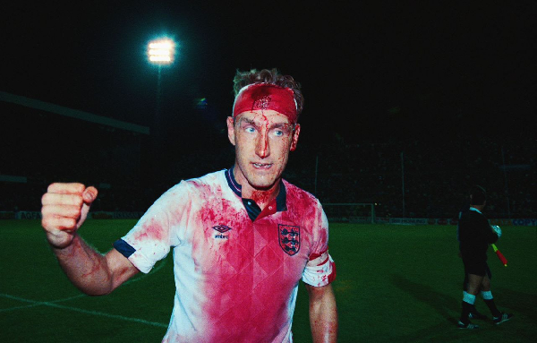 Terry Butcher was soaked in blood yet still played for England
