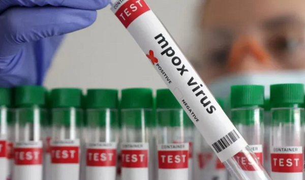 Ghana confirms 6 new Mpox cases, total hits 1,070
